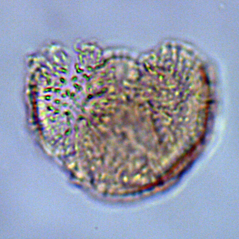 Elytrocysta druggii, U1581-19R-7W, 66-70, sl. 1, M29-1, foto-b.jpg